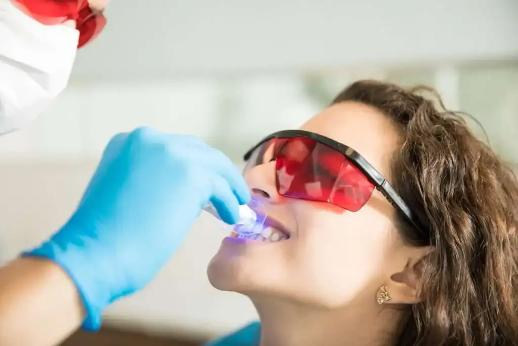 Laser Teeth Whitening FAQs Kempston &ndash; Your Ultimate Guide Kempston